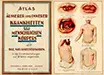 Atlas äusserer und innerer Krankheiten des menschlichen Körpers - Bilz, F. E.